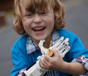 A laughing young boy squats, holding his right, 3D printed hand to his chest and holding an e-Nable necklace with his left hand.